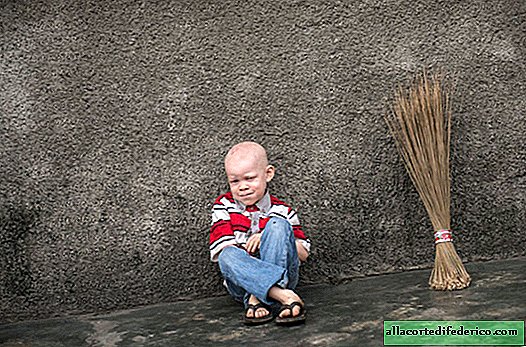 23 dramatic shots from the life of albinos. People you will not envy