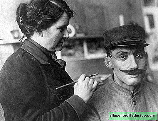 כיצד הצילה אישה את חייהם של ותיקי מלחמת העולם הראשונה על ידי "השבת" פניהם