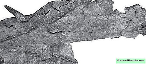 Warum "Zähne raus" ein Plesiosaurus aus Deutschland